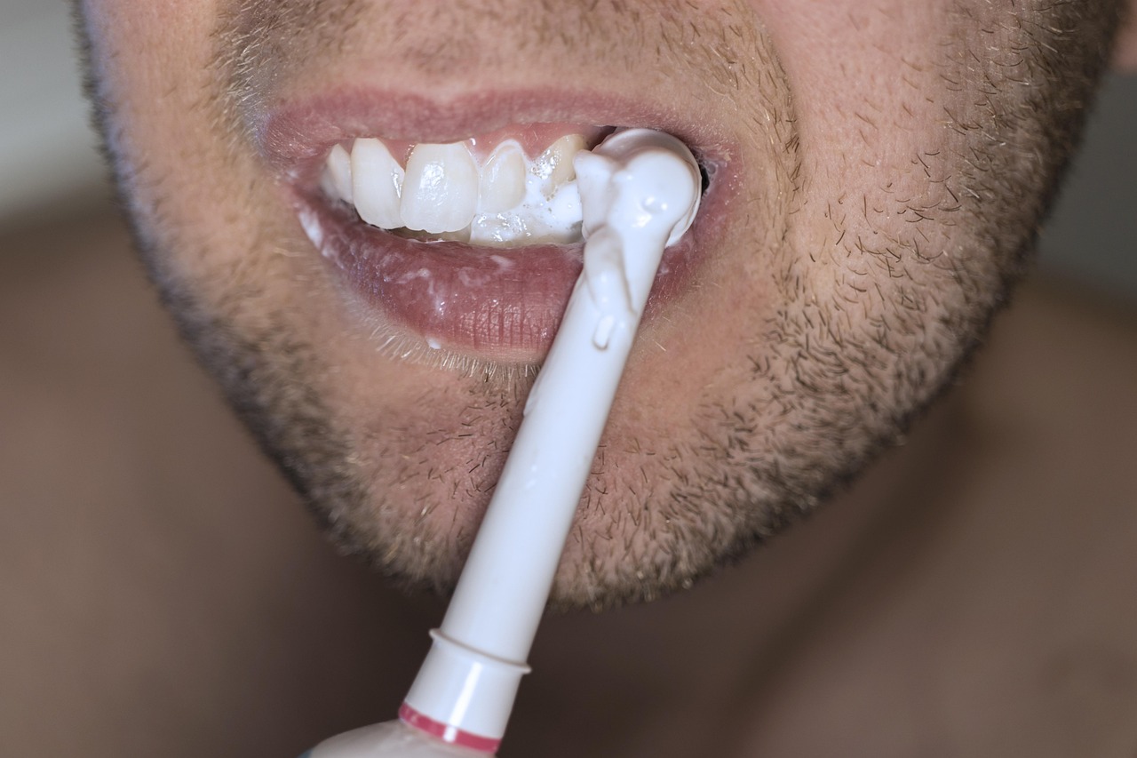 Teeth Whitening