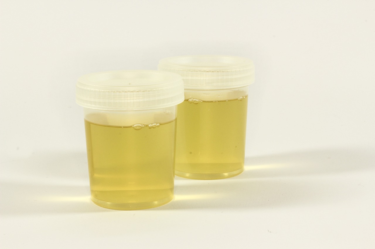 Drinking Your Own Urine to Stay Hydrated