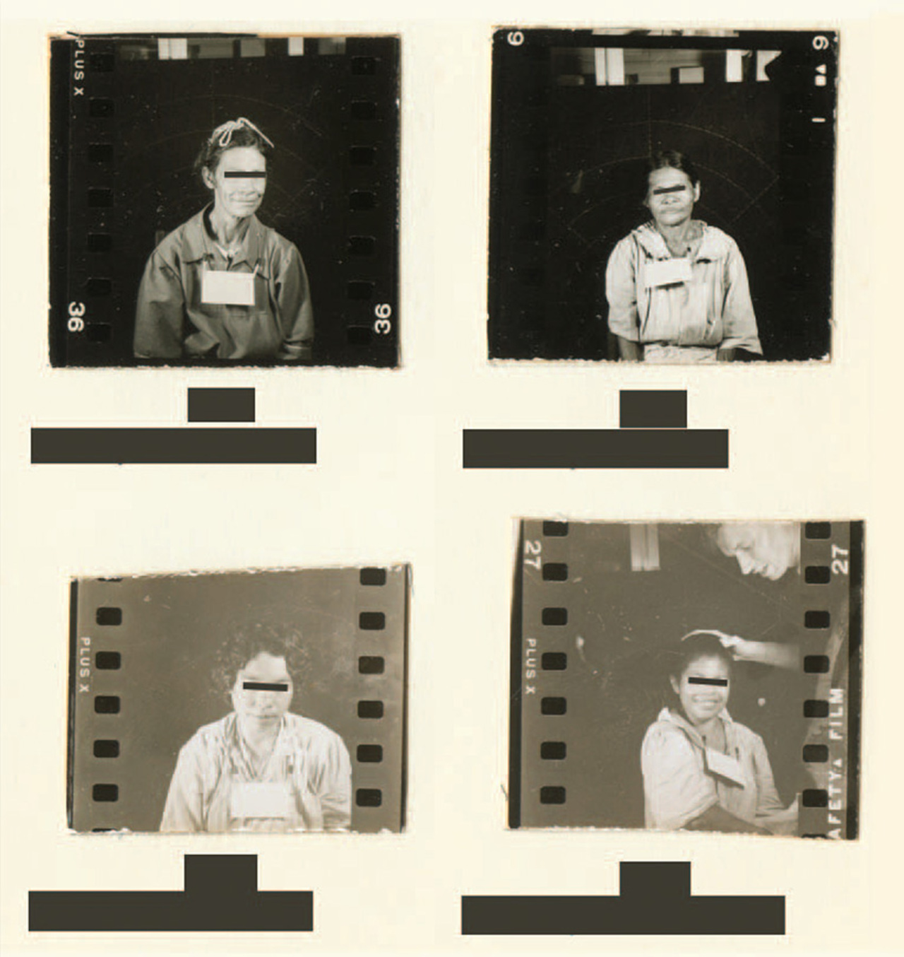 Guatemala Syphilis Experiments